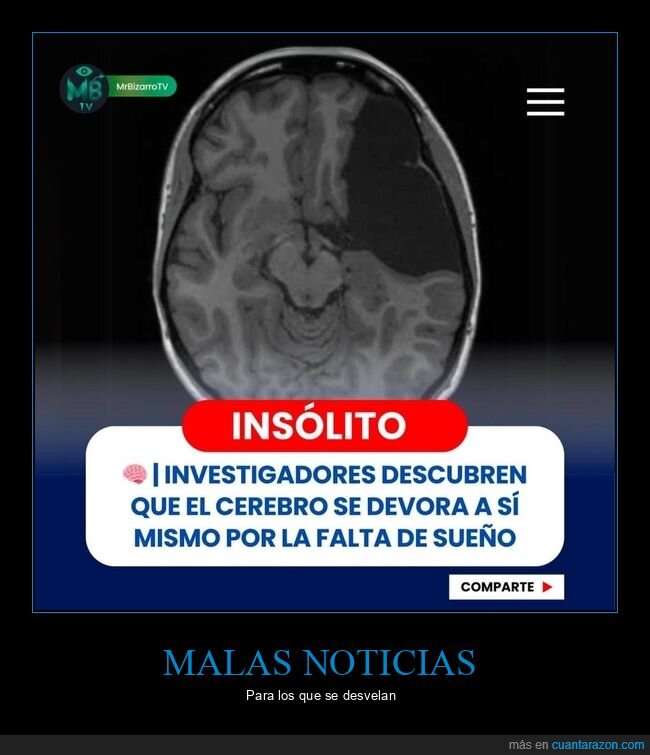 cerebro,devorarse,sueño