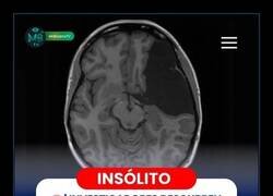 Enlace a Cuidado con dormir poco