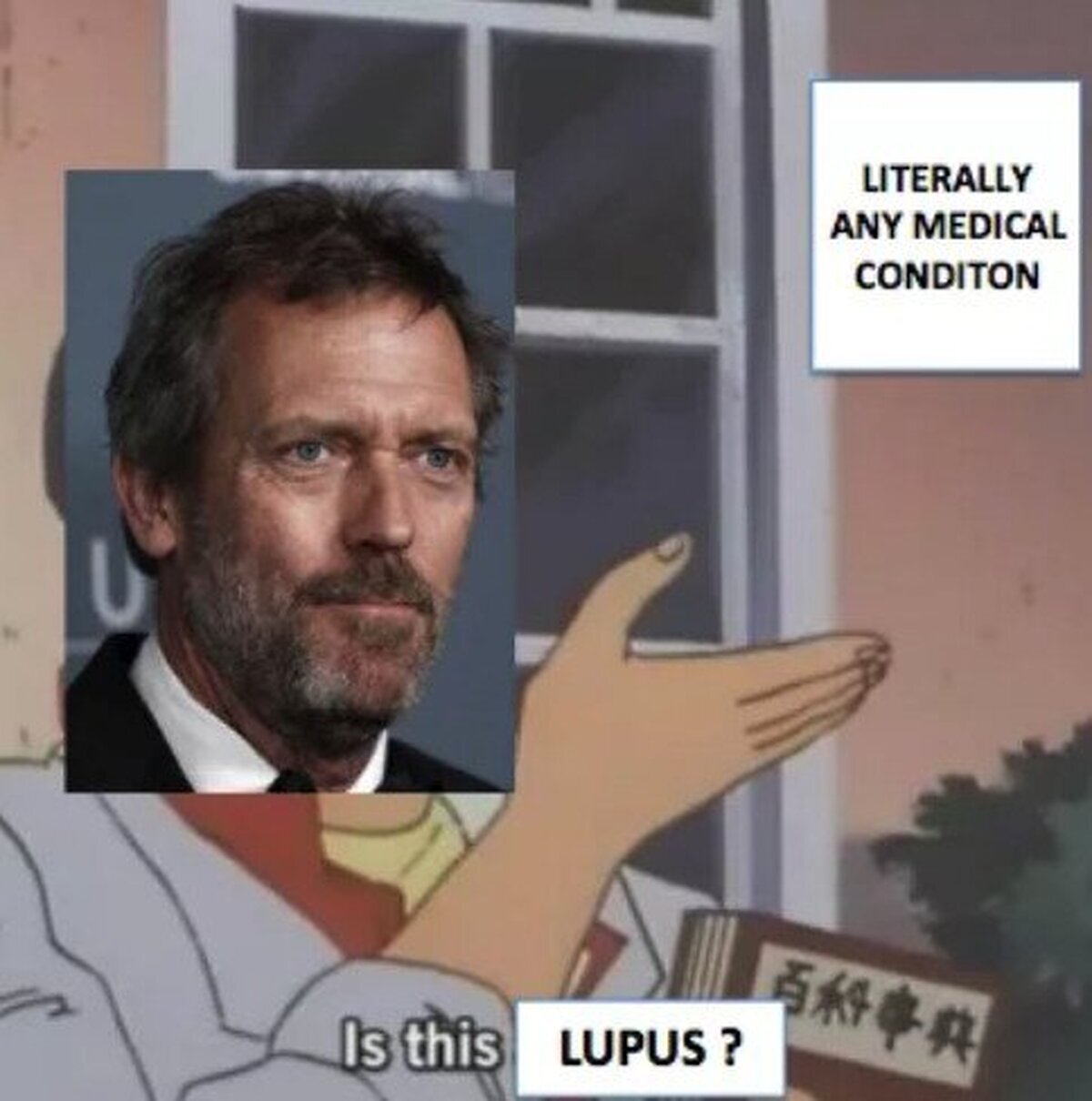 Todo era lupus