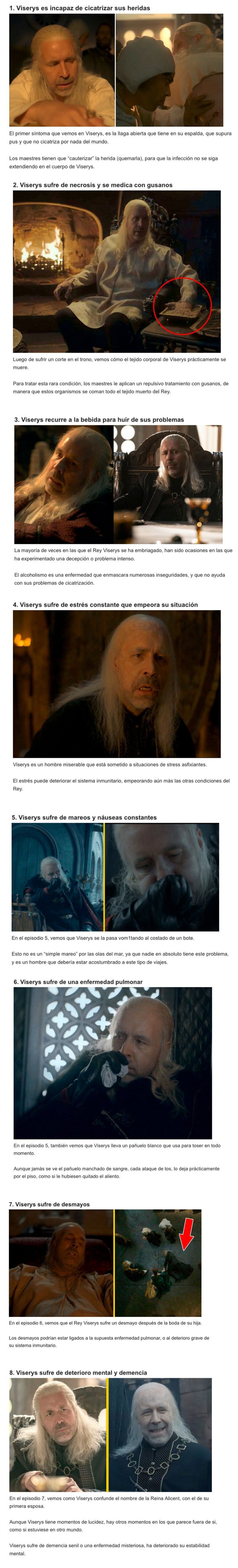 GALERÍA: 8 Enfermedades extrañas que el Rey Viserys ha soportado en “House of the Dragon”