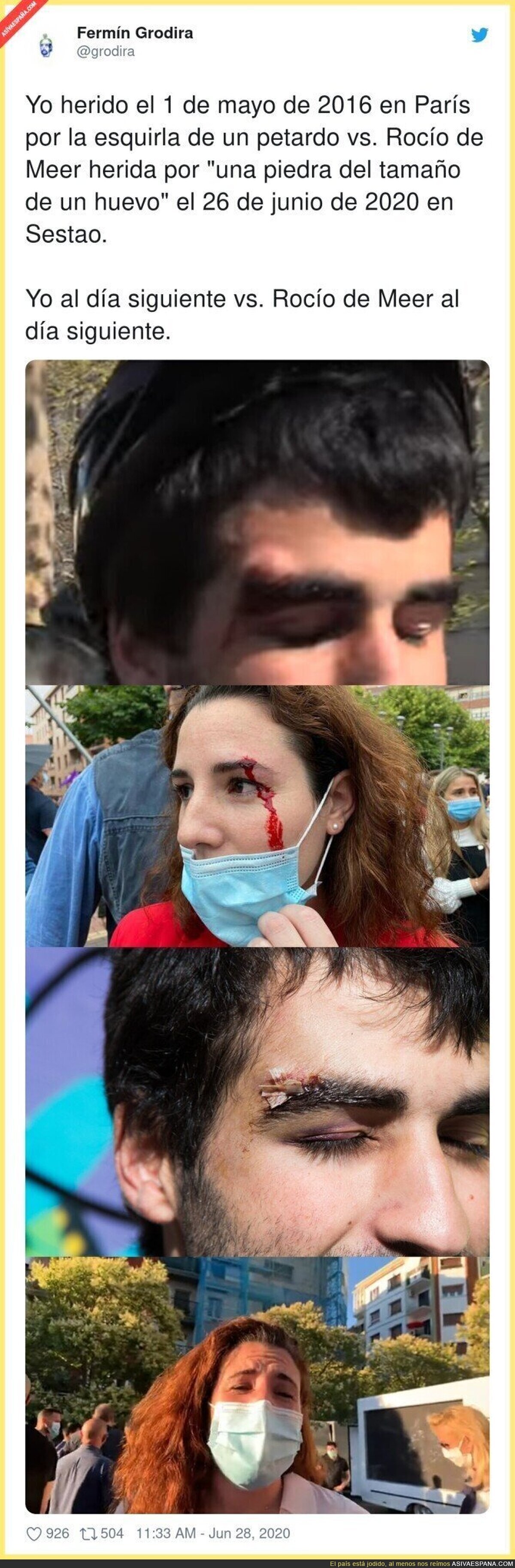 Lo quieren acaparar todo, hasta los Goya. Gran maquillaje el de VOX