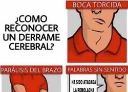 IQ bajo m&iacute;nimos