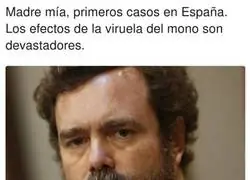 Te deja muy  mal esa viruela del mono