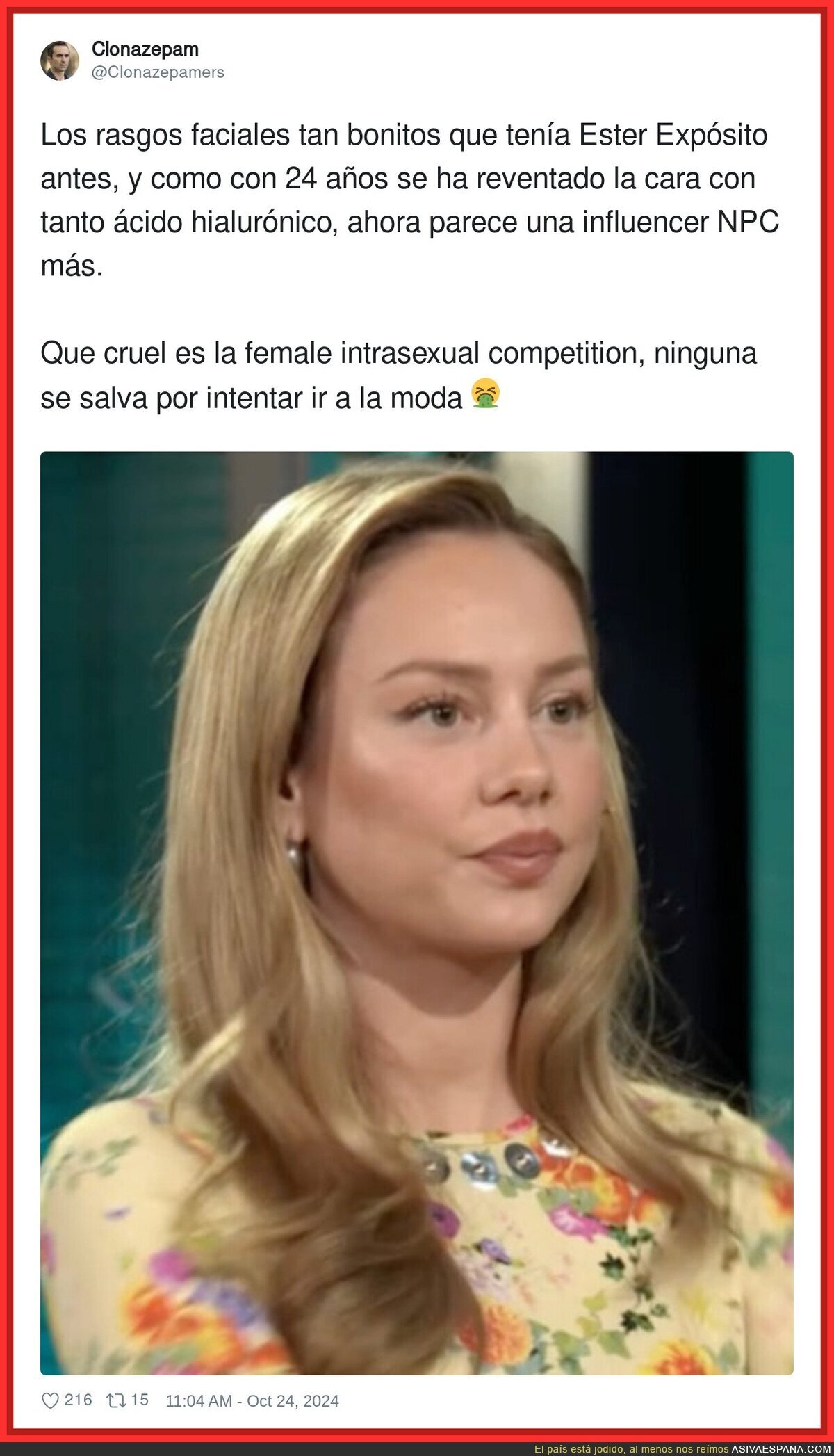 Ester Expósito y su polémica nueva imagen