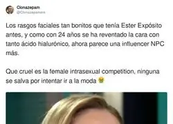 Ester Exp&oacute;sito y su pol&eacute;mica nueva imagen