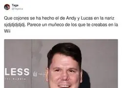 Vaya destrozo se ha hecho en la cara Lucas
