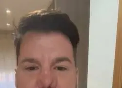 Cada d&iacute;a que pasa la nariz de Lucas es diferente