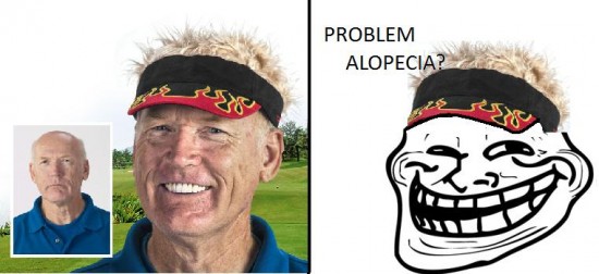 Trollface - Problem alopecia?