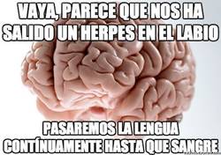 Enlace a Y es así cómo nunca te curas de los malditos herpes