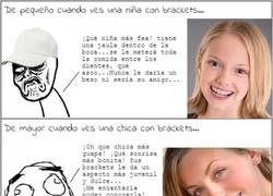 Enlace a Los brackets a medida que crecemos