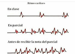 Enlace a Ritmo cardíaco estudiantil