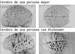Enlace a Distintos tipos de cerebros