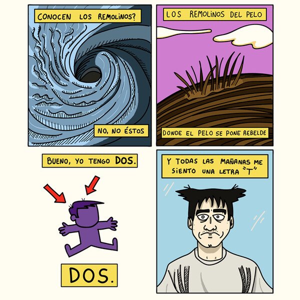 Otros - Los terribles remolinos en el pelo