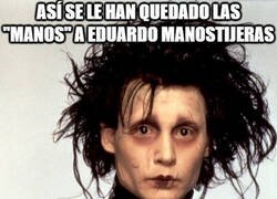 Enlace a No todos le sientan bien lavarse las manos para desinfectarlas...