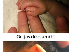 Enlace a Algunas anomalías genéticas pueden ser extraordinarias