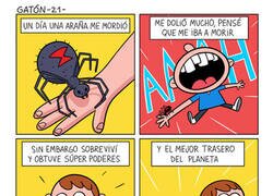 Enlace a Me dolió mucho que me mordiera una araña