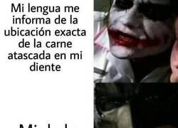 Enlace a No se coordinan bien