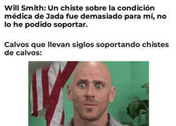 Enlace a Lo que los calvos han tenido que aguantar durante años