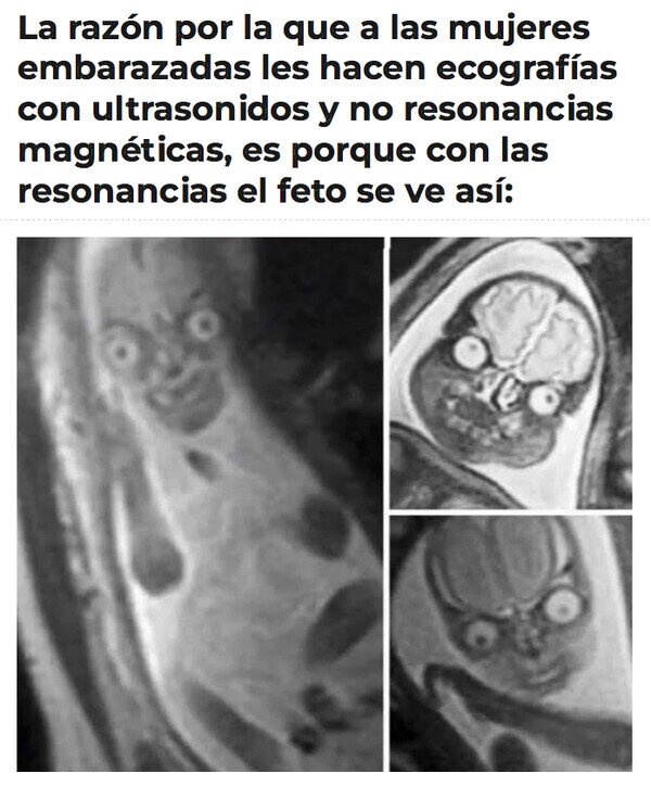 Meme_otros - Da un poco de cosa...