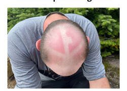 Enlace a Personas que tuvieron problemas tomando el sol