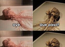 Enlace a El sistema nervioso poniéndose nervioso