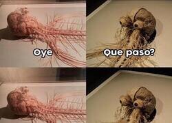 Enlace a Los nervios