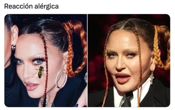 Otros - ¿Qué mosca le ha picado a Madonna?