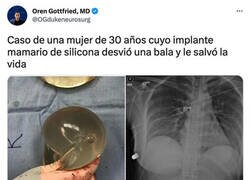 Enlace a + 40 de Defensa