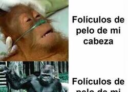 Enlace a Maldita genética