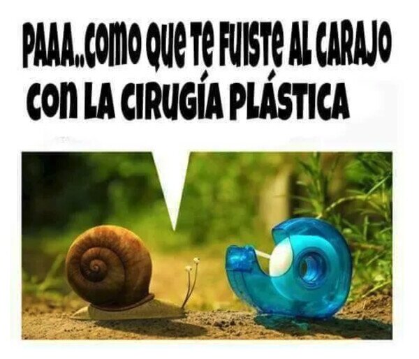 Otros - Se pasó con la cirugía
