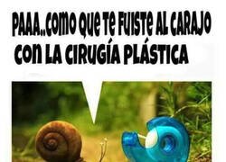 Enlace a Se pasó con la cirugía