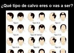 Enlace a ¿Qué tipo de calvo eres?