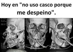 Enlace a Al menos no murió despeinado