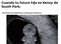 Enlace a Va usted a tener un Kenny