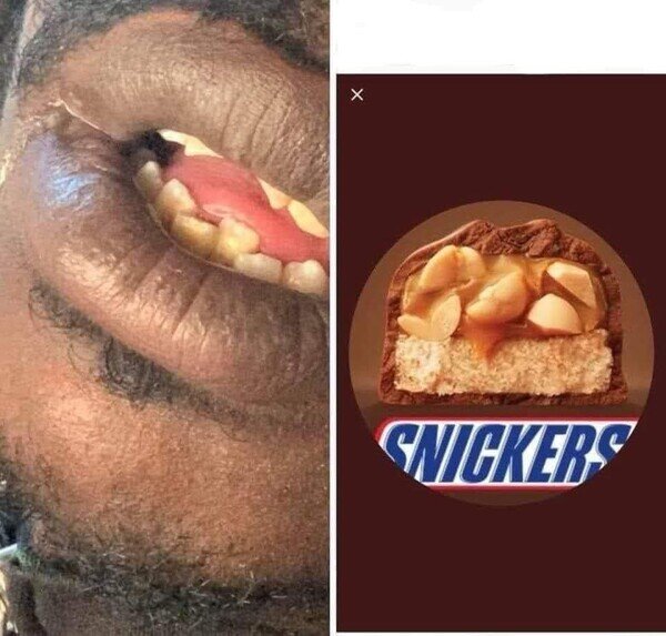 Otros - Esa boquita dulce como Snicker