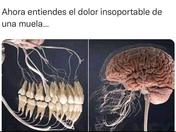 Meme_otros - Malditas y dolorosas muelas