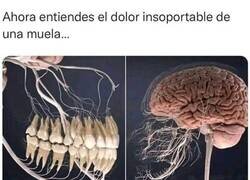 Enlace a Malditas y dolorosas muelas