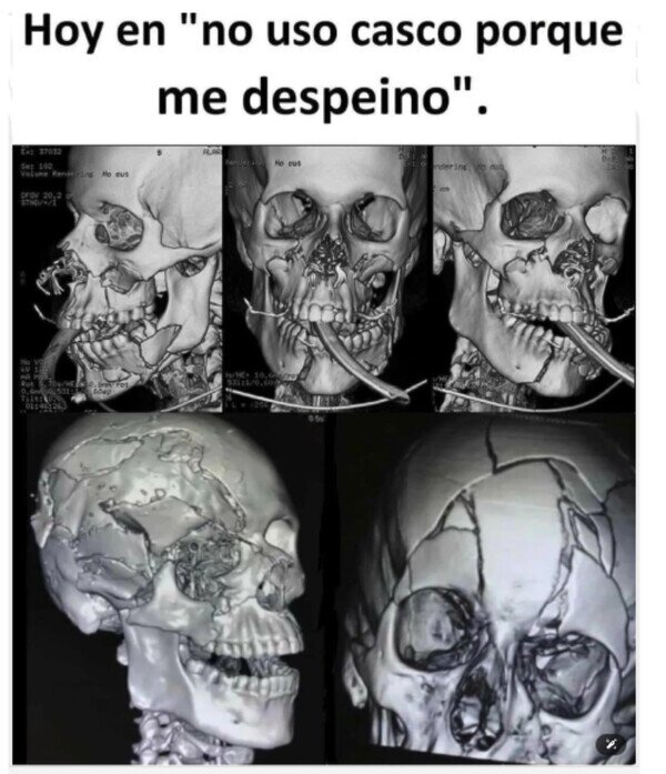 Meme_otros - Mejor despeinarse que descabezarse