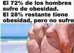 Enlace a Los hombres que sufren de obesidad