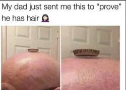 Enlace a La prueba de que mi padre no es calvo