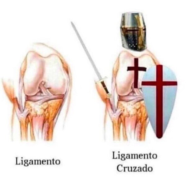 Otros - La tontería del día