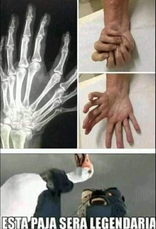 Meme_otros - Imagina tener esa mano