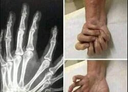 Enlace a Imagina tener esa mano