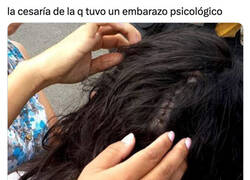 Enlace a Complicaciones en el parto