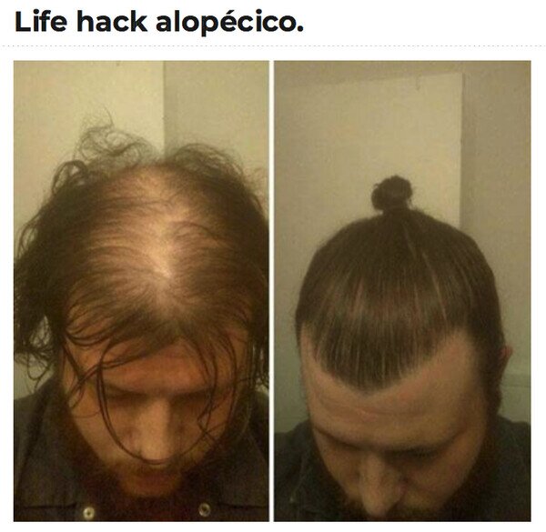 CC_2818324_1de3038772c74483967c65b5d5911fea_meme_otros_truco_para_alopecicos.jpg