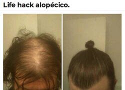 Enlace a Truco para alopecicos