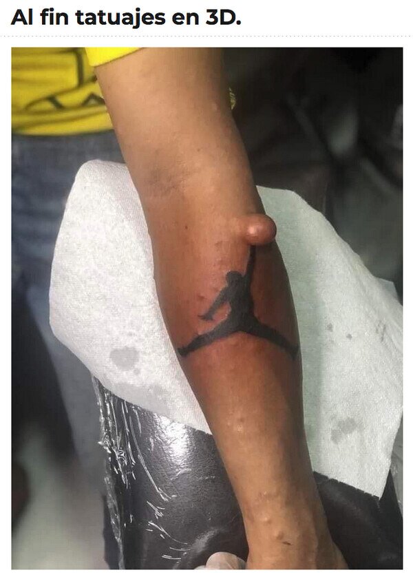 Meme_otros - Fue al tatuador en lugar de al médico