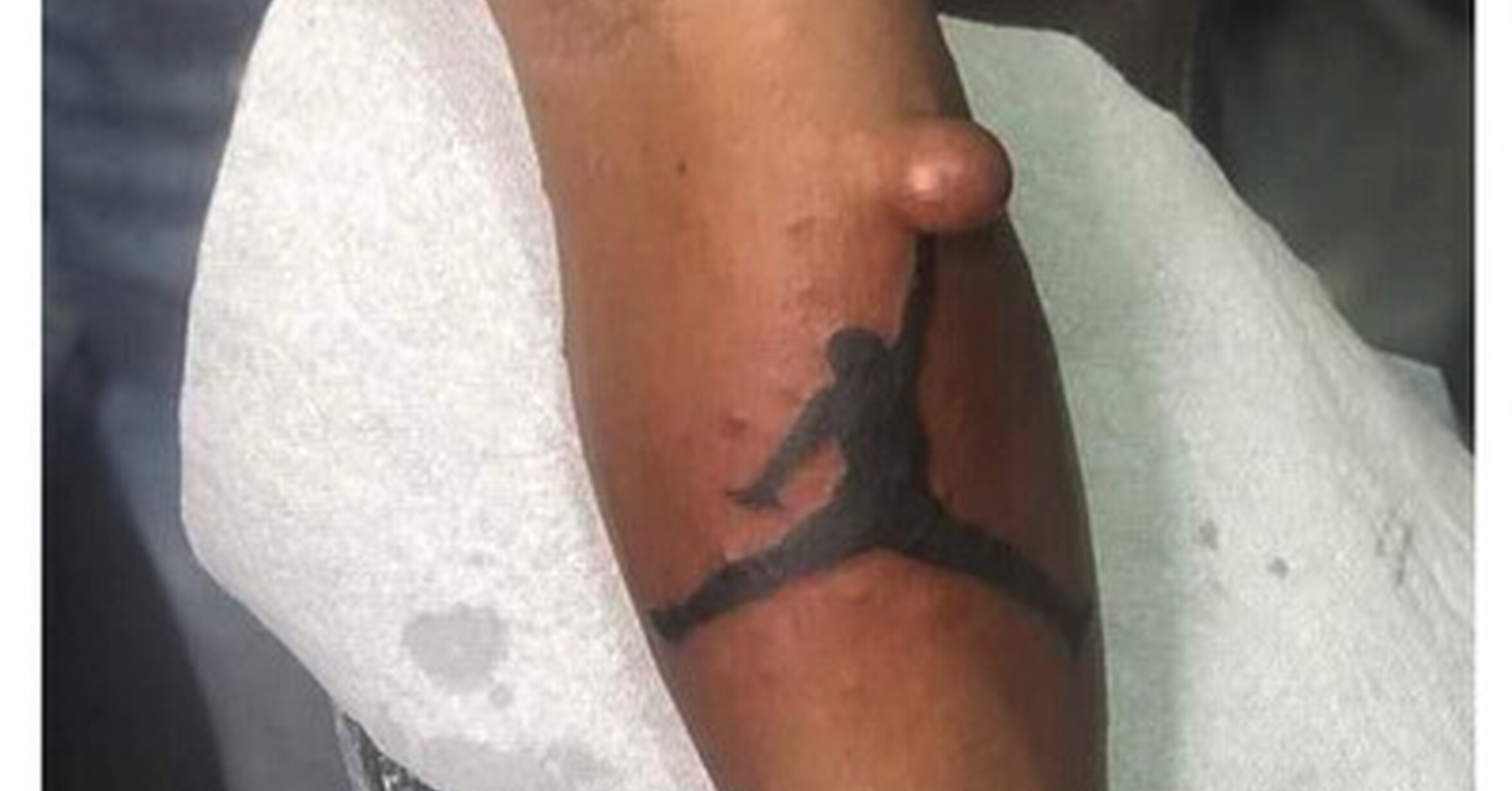 Fue al tatuador en lugar de al médico