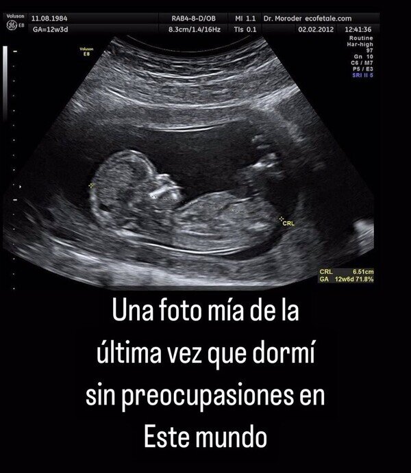 Otros - A partir de ahí todo se torció