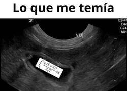 Enlace a Lo que me temía